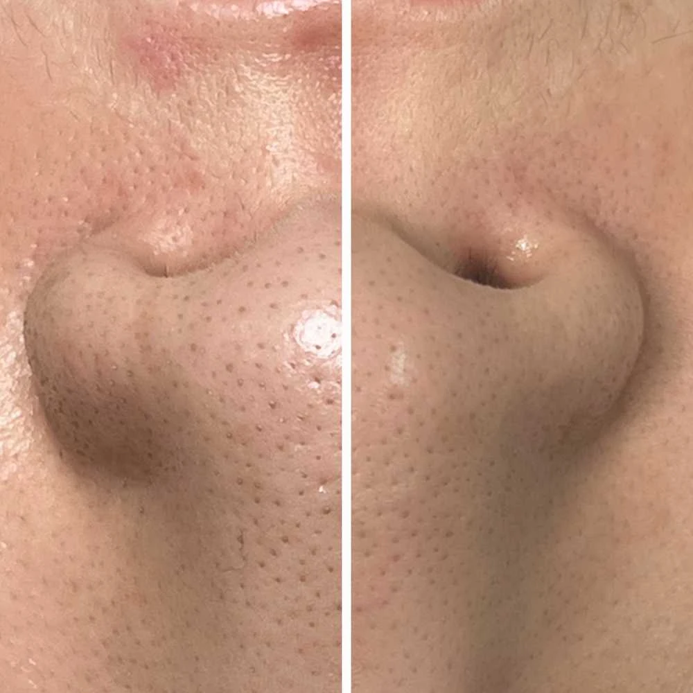 Valomasis aliejinis prausiklis ByTheQuality PerfecQuick Eraser Oil