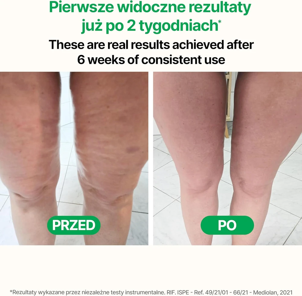 TESMED rankinis anticeliulitinis masažuoklis „Rose“, rožinis, plastikinis volas kūnui