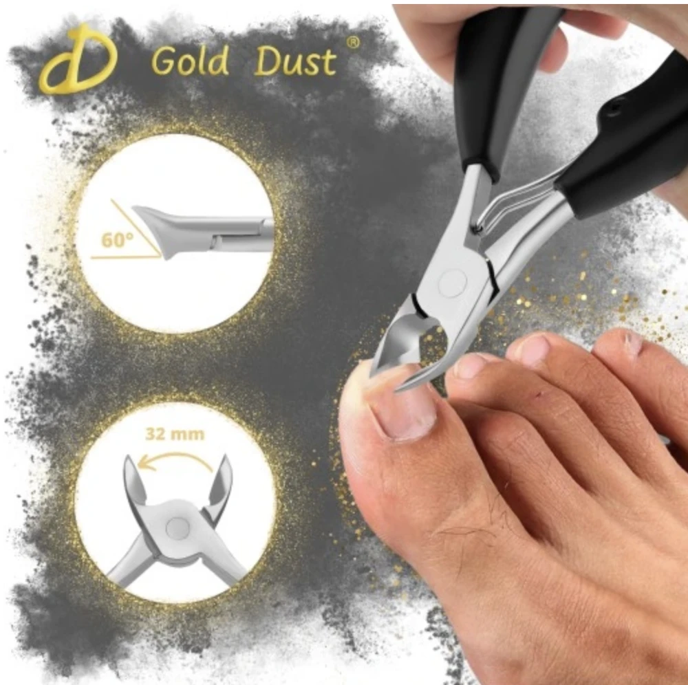 Įaugusių nagų žnyplutės Gold Dust