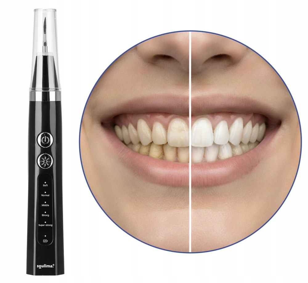 Dantų šepetėlis Soulima 25746 Ultrasonic Dental Scaler