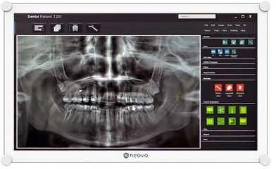 Monitorius Neovo DR-2202 21,5 IN FHD 1920 x 1080