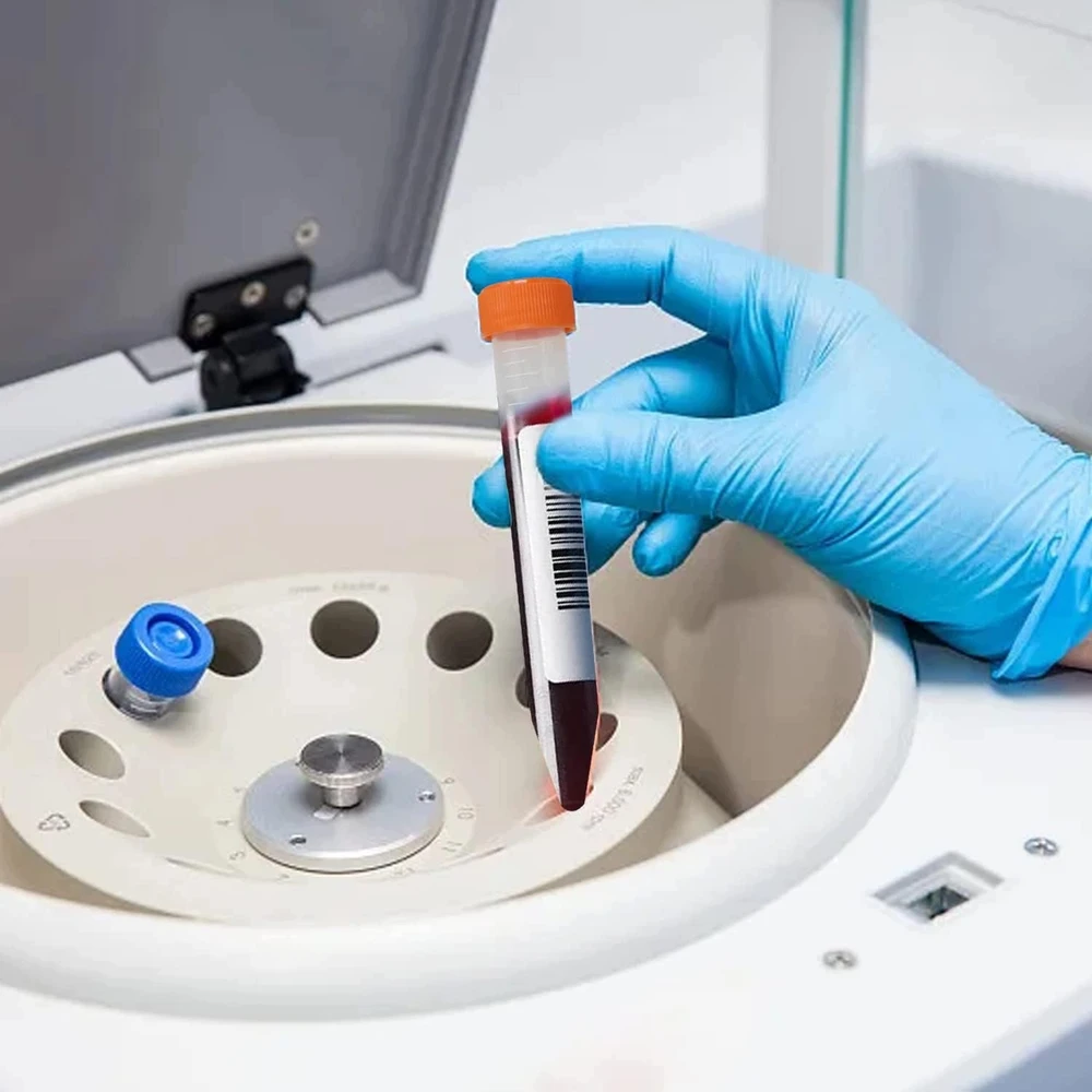 10 ml MĖGMENIS 40 Vnt. KŪGINIO PLASTIKO LABORATORIJA SU dangteliu