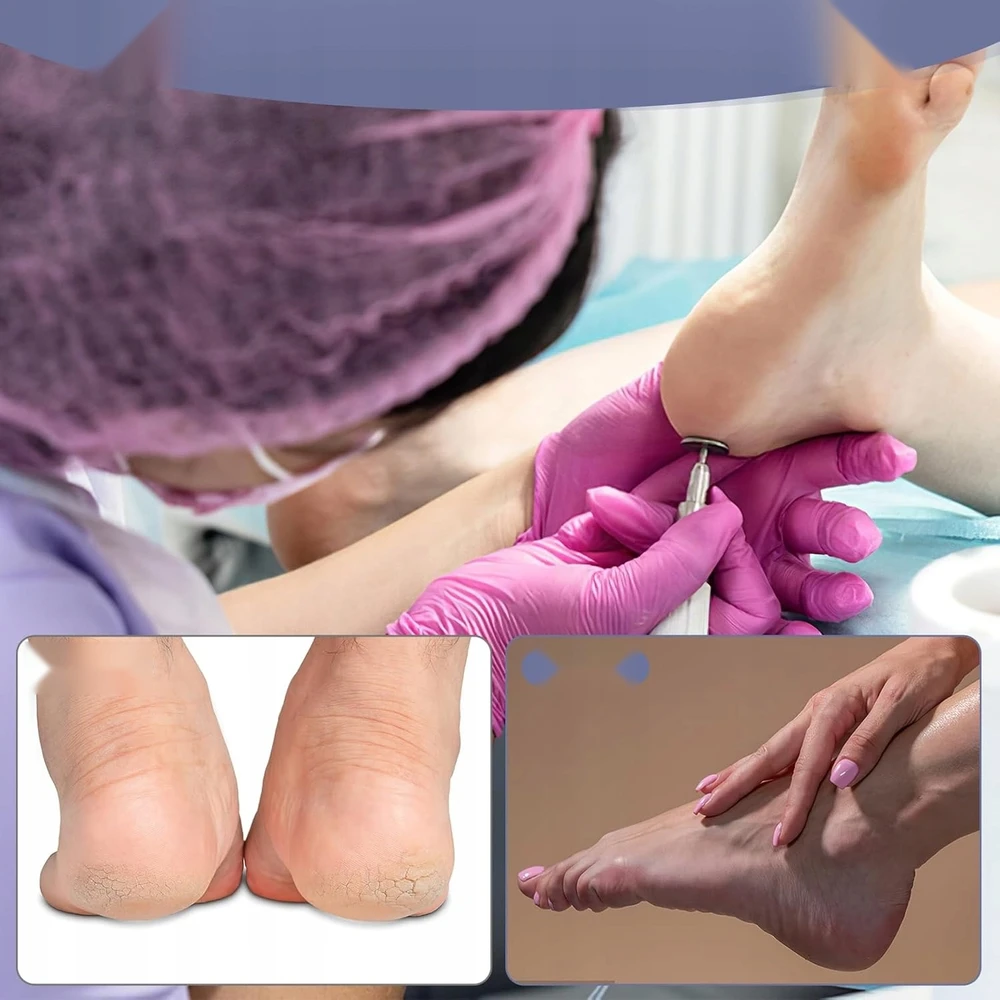 APVALUS ŠVIRTINIMAS