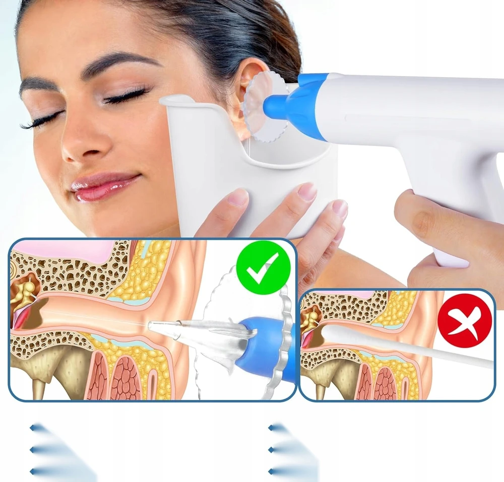 AUSŲ IŠĖMIMO RINKINYS SAUGU, PATOGU, ERGONOMIKUS