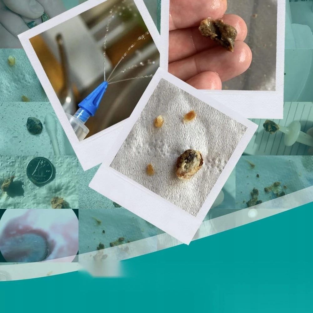 Bez Marki Ausų skalavimo skystis 200ml, trys silikoniniai antgaliai ausų sierui pašalinti