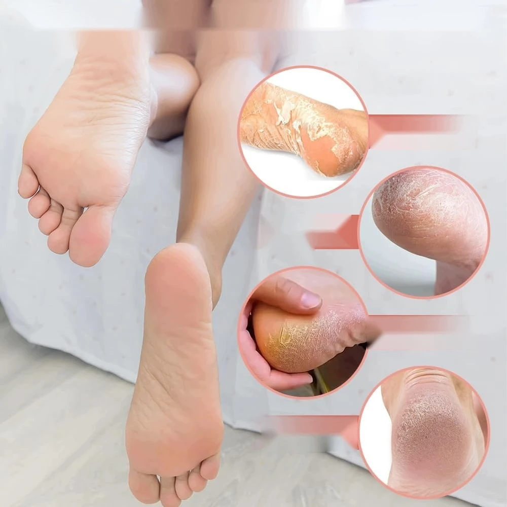 Bez Marki PAKEITIMAI PĖDŲ DILTELĖMS 43MM 60 Vnt. ILGUS HIGIENOS RINKINYS