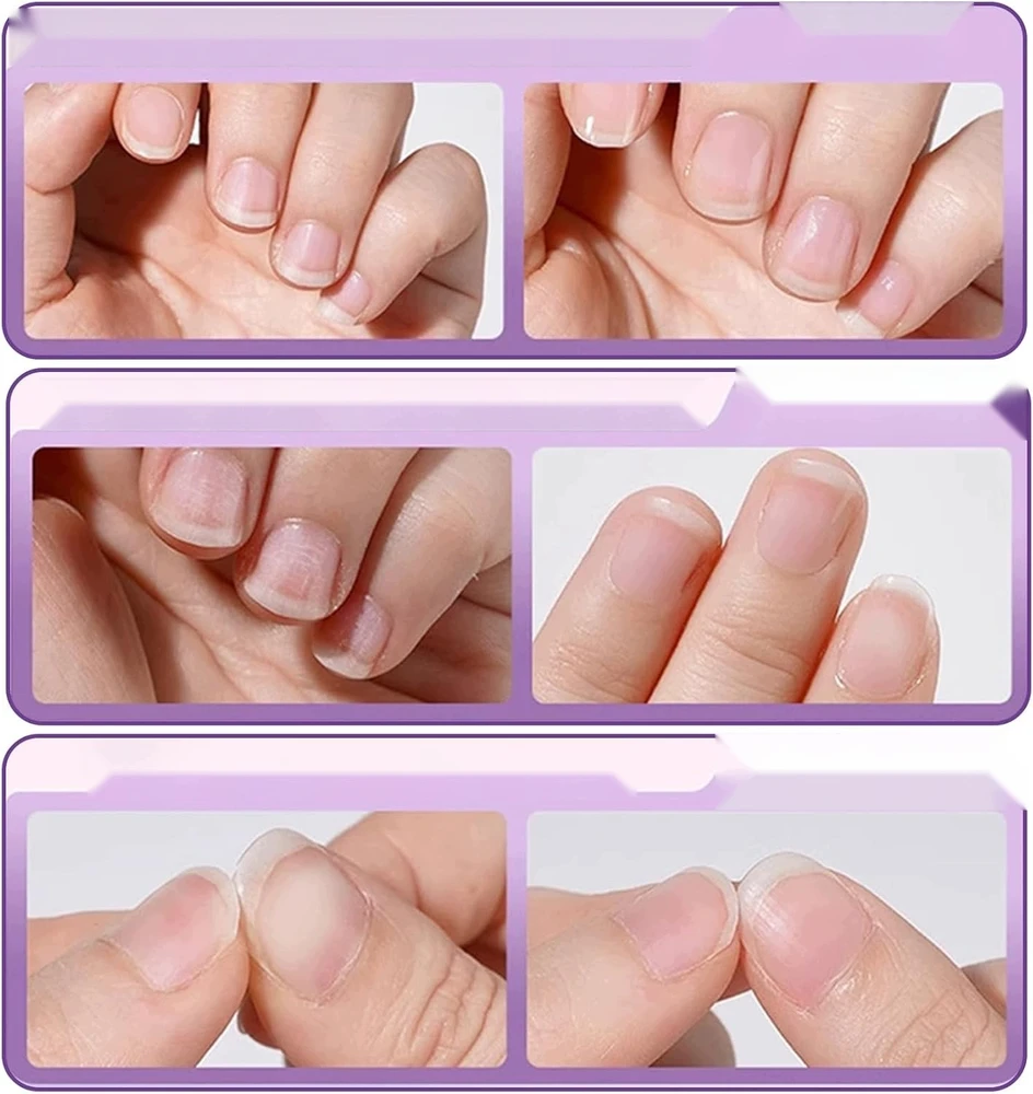 NAGŲ ALIEJUS 3IN1 3 VIENŲ RINKINYS CARE PEN STRONG