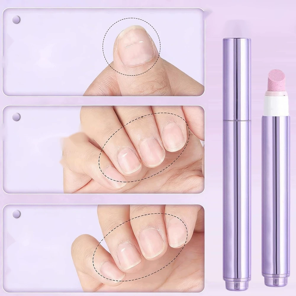 NAGŲ ALIEJUS 3IN1 3 VIENŲ RINKINYS CARE PEN STRONG
