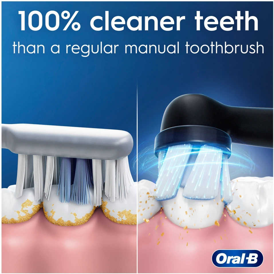 Oral-B iO 2 elektrinis dantų šepetėlis – juodas