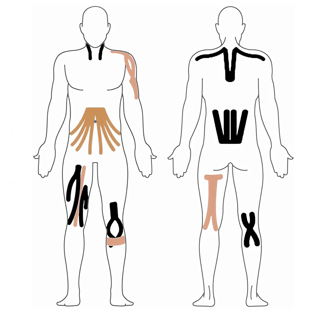 Plastry Kineziologinis teipavimas, pleistrai, „Kinesio Sport Pro Tape“, 5Mx5CM