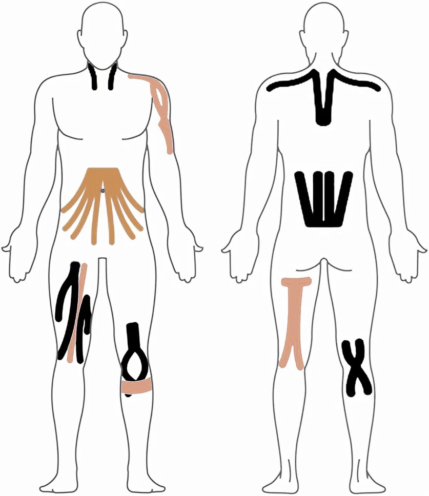 Plastry Kineziologinis teipas, kinesio pleistras 5cmx5m, geltonas