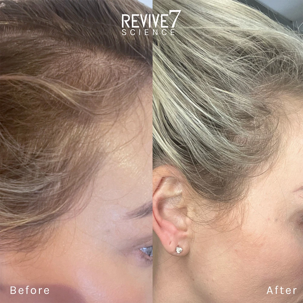 „Revive7“ – plaukų kaukė, 30 ml