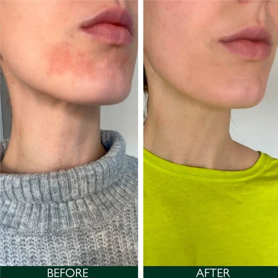 Sorted Skin Intensive Rescue Face Lotion intensyvaus poveikio veido losjonas jautriai odai, 50 ml