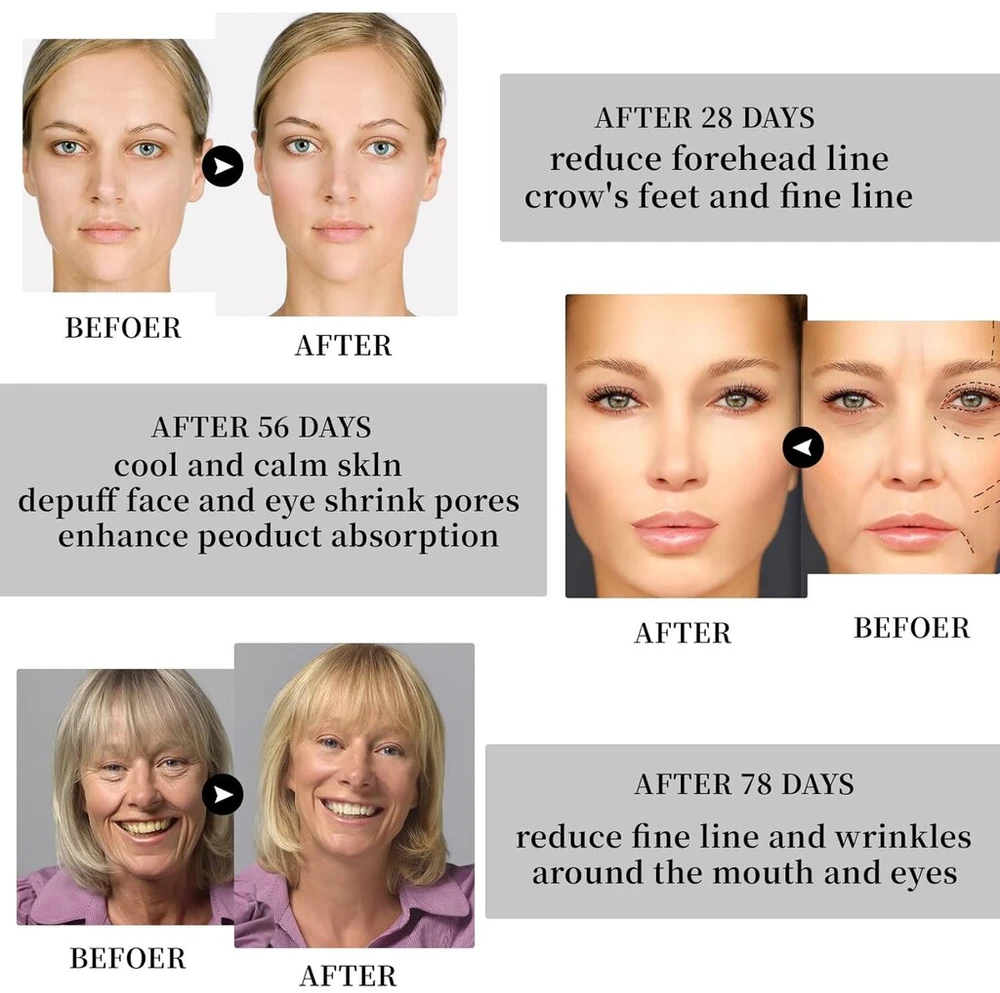 Anti-aging masažuoklis veidui ir kaklui