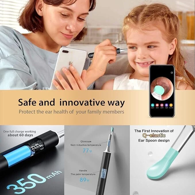 Bebird 1080p