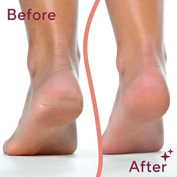 Pedi AF24