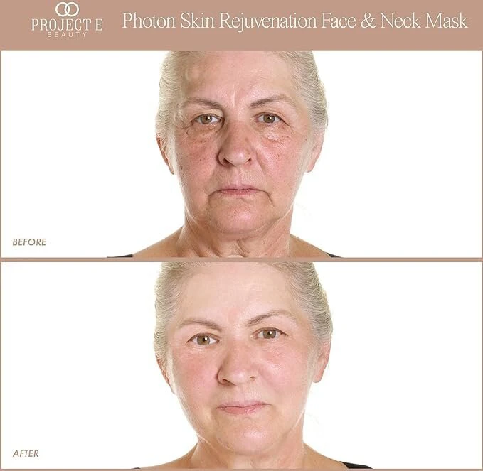 Project E Beauty
