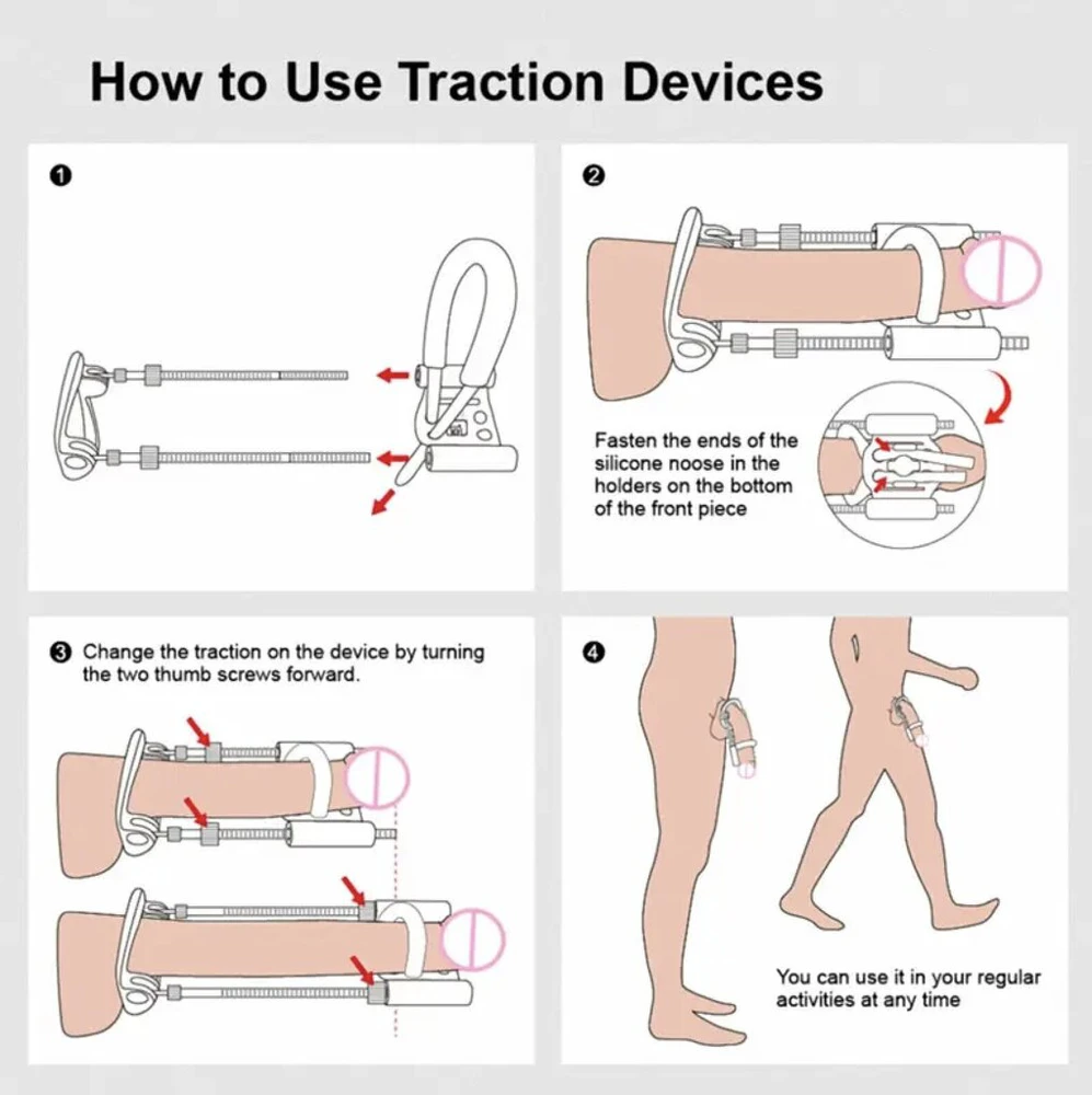 Varpos ilgintuvas Penis Extender