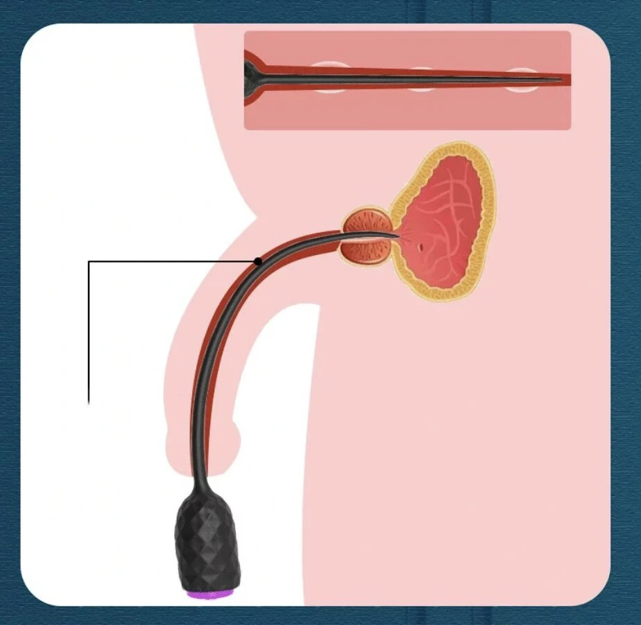 Vibruojanti šlaplės lazdelė Vibrating Penis Plug 5 mm