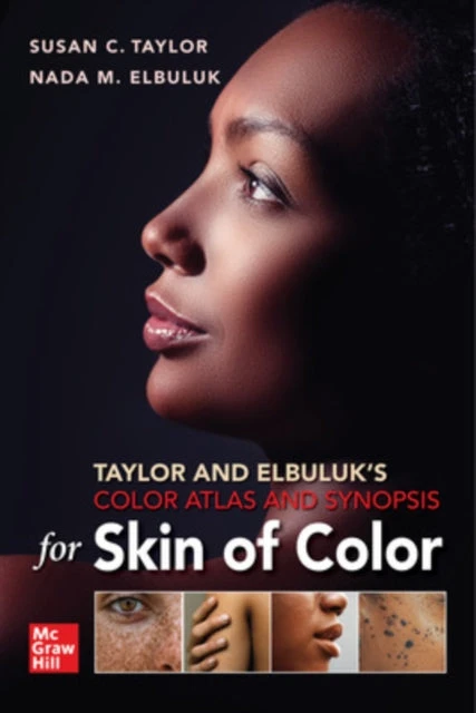 KNYGA Susan C Taylor Taylor and Elbuluk's Color Atlas and Synopsis for Skin of Color