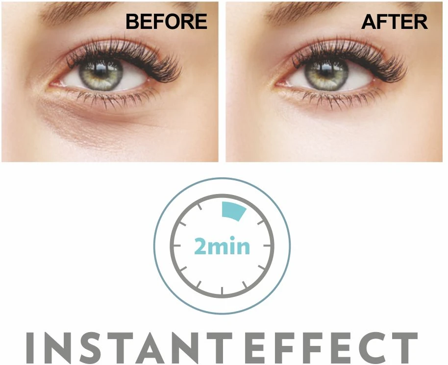 Incarose My Eyes Instant Effect Puffiness And Dark Circles paakių priežiūros priemonė nuo tamsių ratilų 8ml