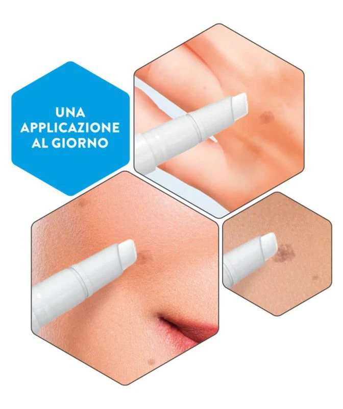 Serumas-PEN prieš pigmentines dėmes, INCAROSE Clair / 2 ml