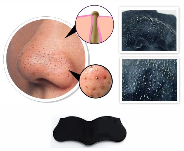 Juostelės nuo juodų taškų ant nosies, SYNERGY DERM Nose Strips / 4 vnt.