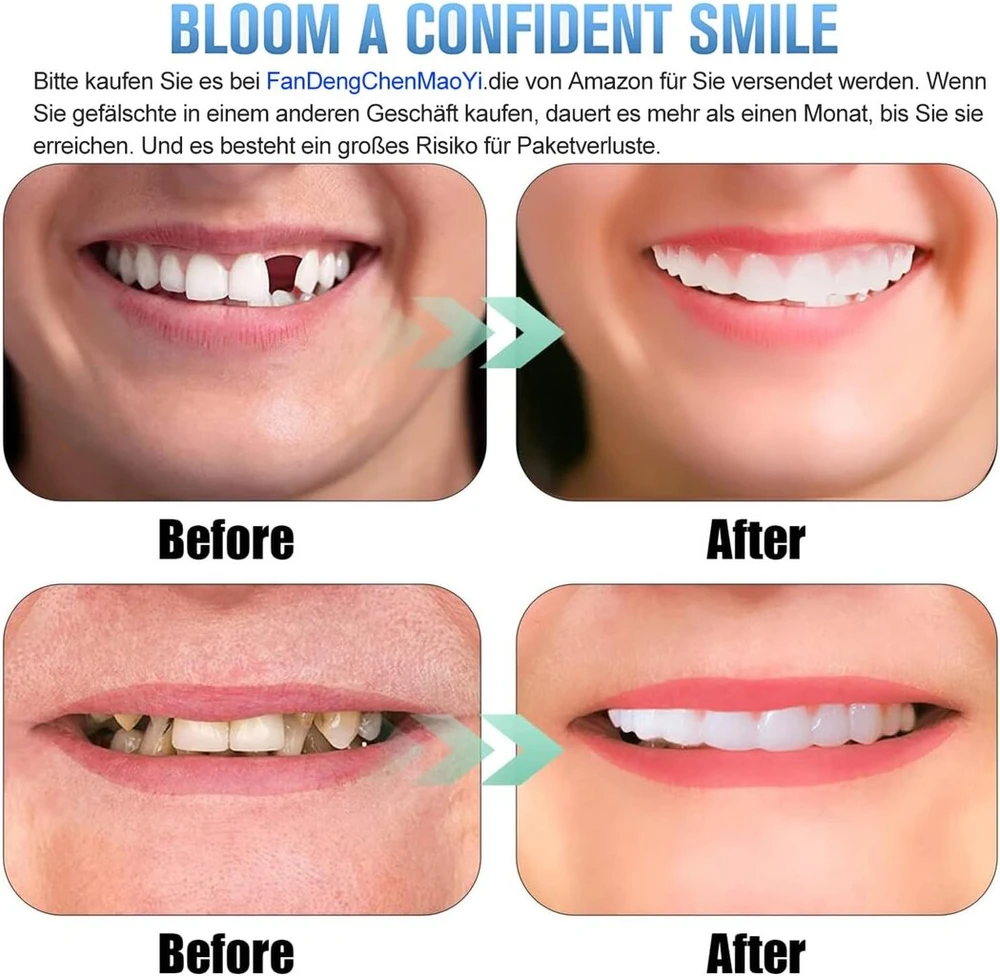 2 poros dantų lukštai Smile, patogūs momentiniai kosmetiniai dantų lukštai viršutiniams ir apatiniams dantims vyrams ir moterims, dantų balinimo uždengimas blogiems dantims