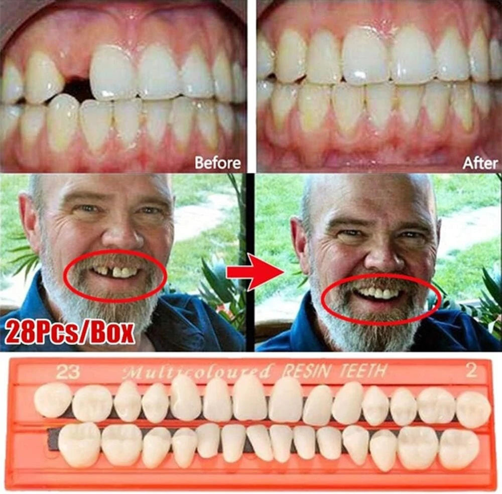 28 vnt. dervos dantų modelis, ergonomiškas dizainas, patvarūs dantų protezai, universalūs dervos dirbtiniai dantys