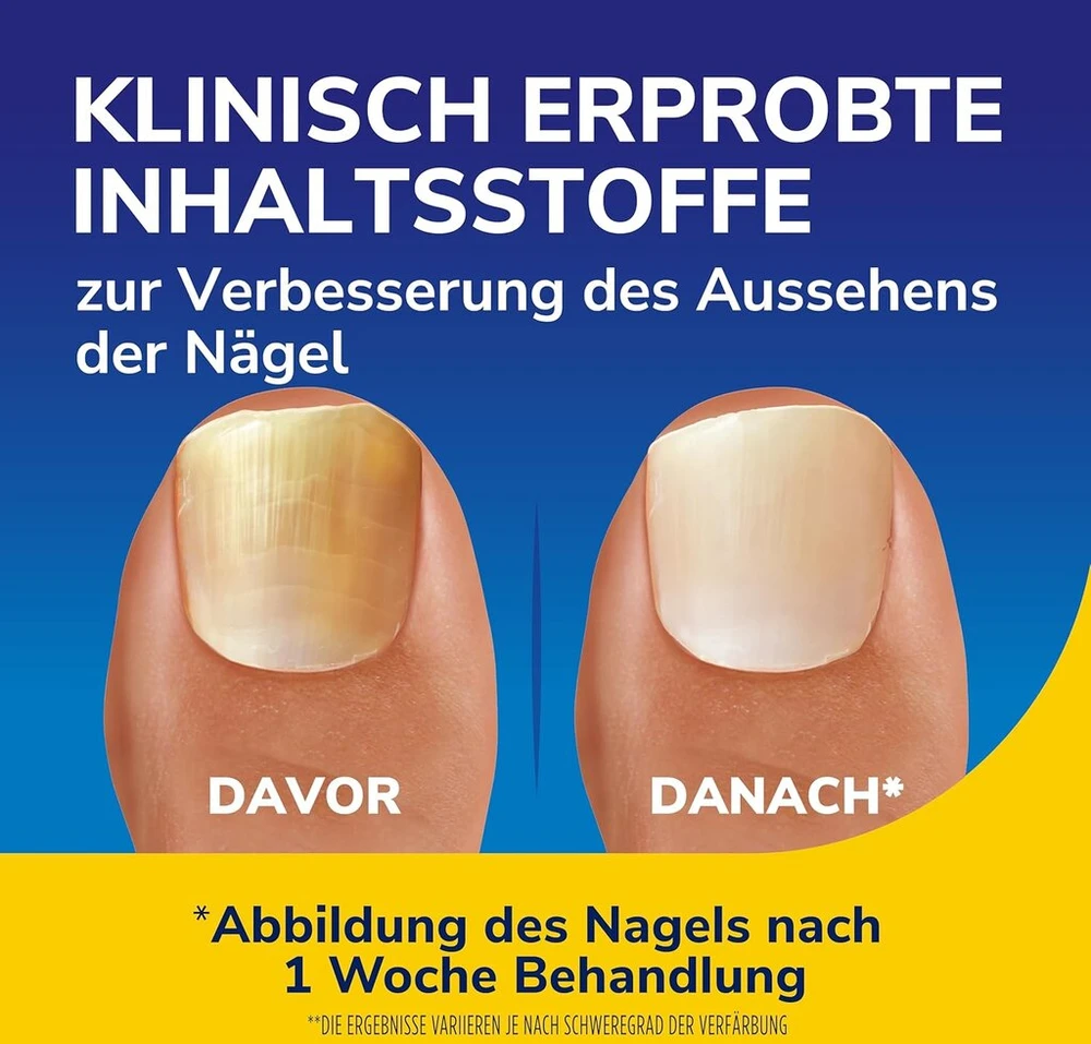 Dr. Scholl's Nail Revitaliser 10ml matomi rezultatai vos per 2 dienas: šviesina, lygina, drėkina, pagerina nagų ir kojų nagų, pažeistų nagų grybelio, išvaizdą