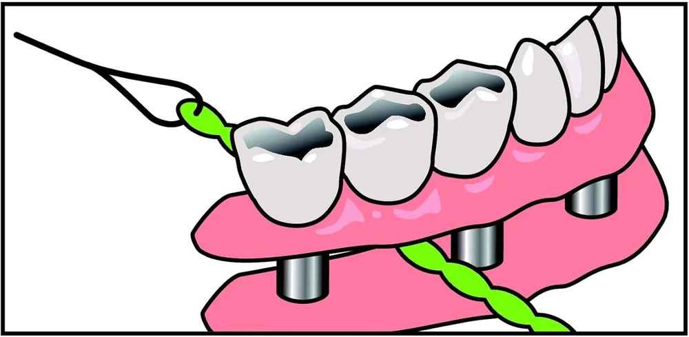 Idontix Brace X-floss tarpdančių siūlas, žalias