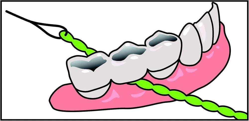 Idontix Brace X-floss tarpdančių siūlas, žalias