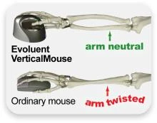 Evoluent Vertical Mouse 4 Left VM4L