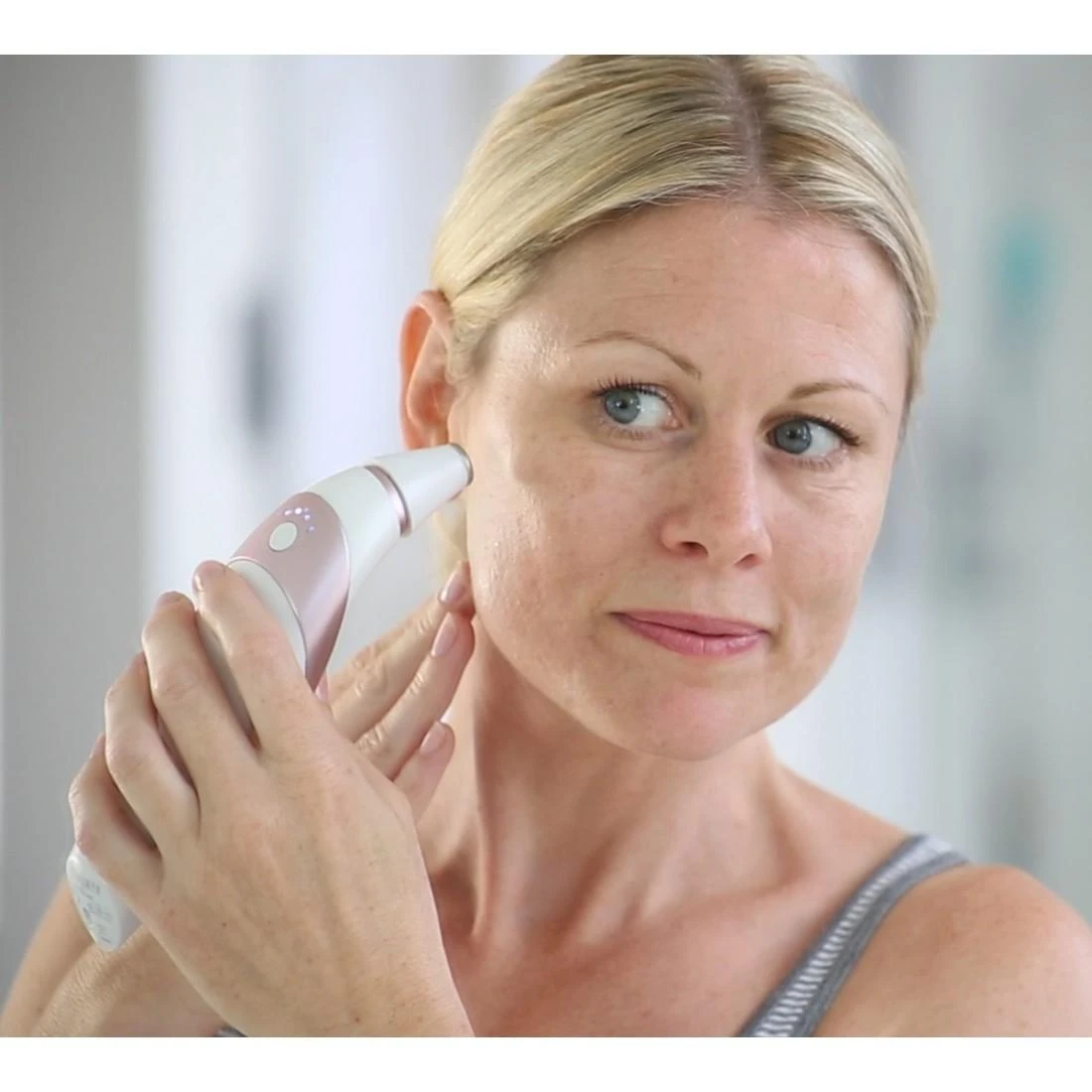 HoMedics – mikrodermabrazija