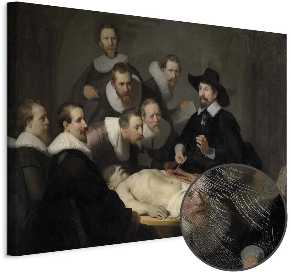 Paveikslas Rembrandt - Daktaro Tulpo anatomijos pamoka