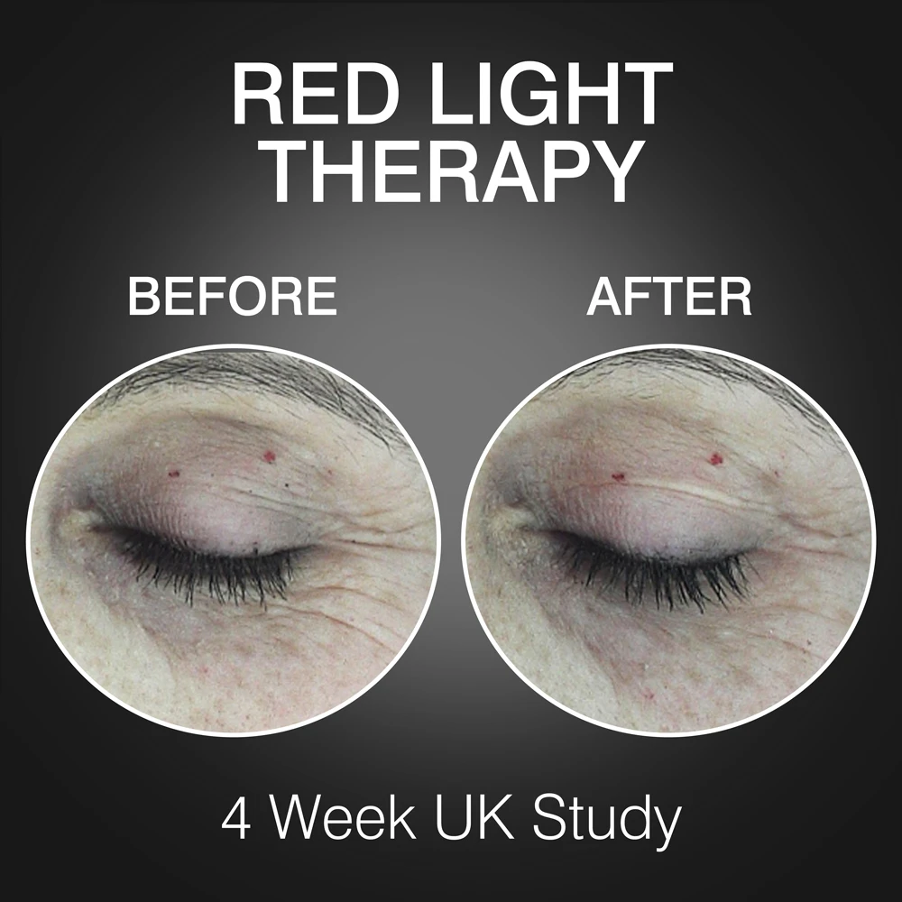 Rio Beauty LED veido kaukė FaceGLO 1072