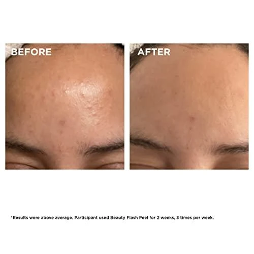 Clarins Beauty Flash Peel, 50 ml