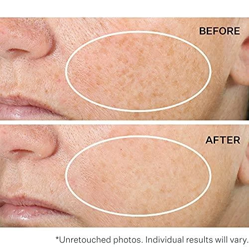 „Strivectin Multi-Action Super-C Retinol Brighten“ – teisingas vitamino C serumas, 30 ml.