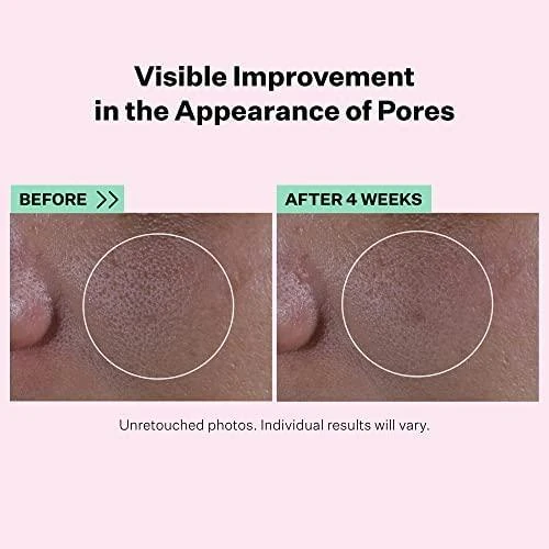 "Strivectin Multi Action Super Poras mažinantis serumas" 30ml