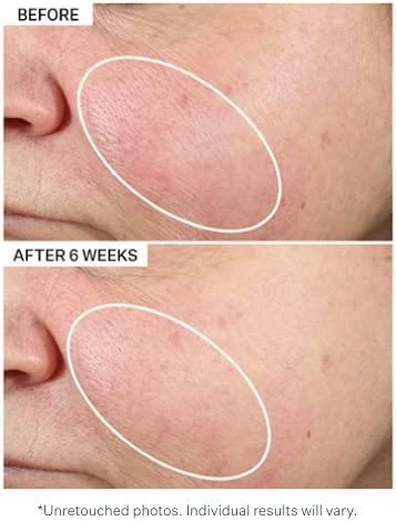 Strivectin Multiaction Super-B odos maitinamasis veido aliejus su prebiotiniu mišiniu 30ml