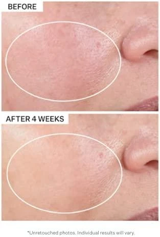 "Strivectin Advanced Retinol Nightly Renewal Moisturizer" Retinolio serumo koncentratas 50ml