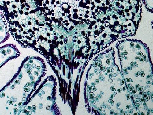 Mikroskopas Bresser 50x-2000x LCD Microscope 8,9cm (3,5 )