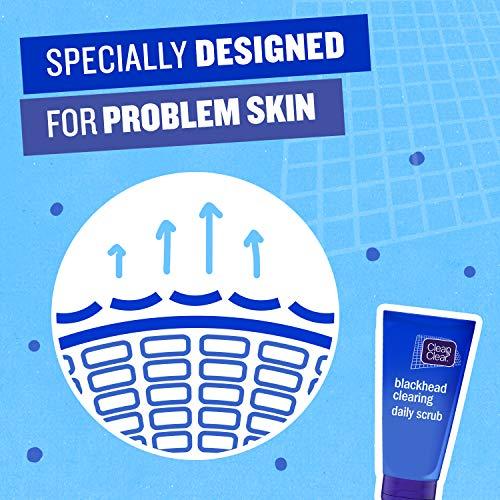 Clean & Clear Peeling gelis nuo inkštirų 150ml