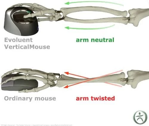 Pelės Evoluent VerticalMouse 4 (VM4L)