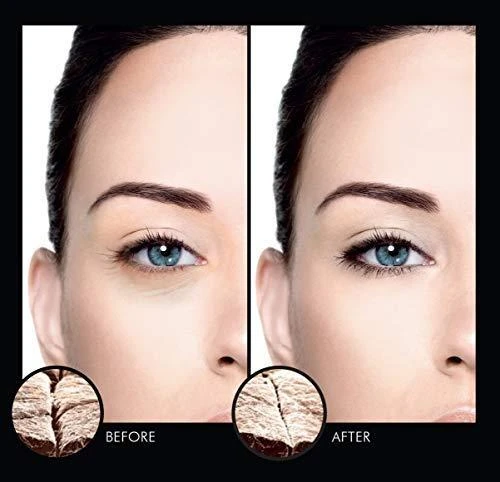 Talika Eye Therapy Patch Refill padeliai paakiams, 6 poros