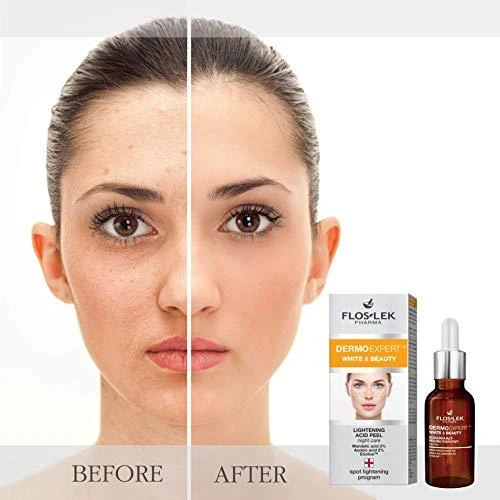 Floslek Dermo Expert - Peelingi Kwasowe, 30 ml