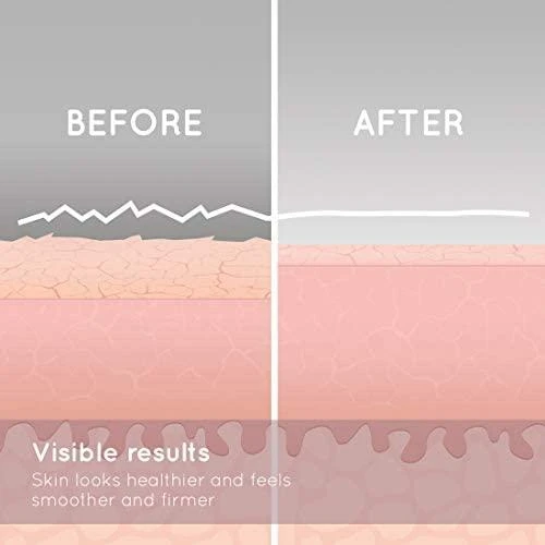 HoMedics – mikrodermabrazija