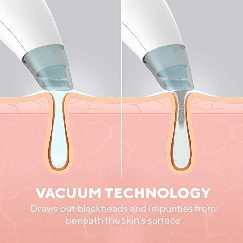 Homedics FAC-HY100 gaivinamoji drėkinamoji veido procedūra