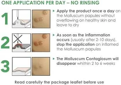 Acm Molutrex tirpalas 3ml