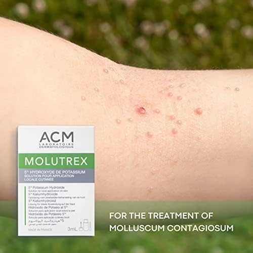 Acm Molutrex tirpalas 3ml